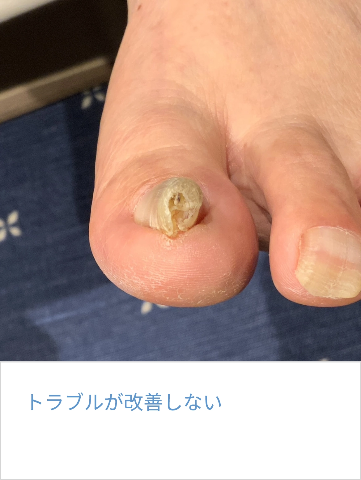 グループ 384